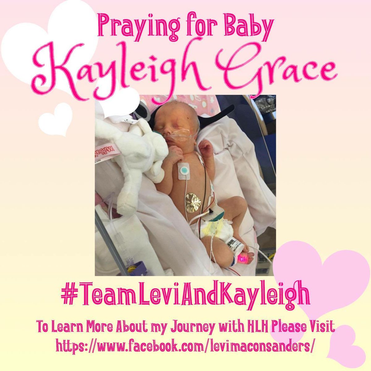 AmberHSanders's tweet photo. Kayleigh was born 8 weeks early and was flown to Cincinnati childrens to begin treatment and bone marrow transpl https://t.co/Sw0drLFwF5