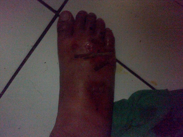 dihan_ardli's tweet photo. Ya alloh kaki ku -_- https://t.co/d5loM6hNWs
