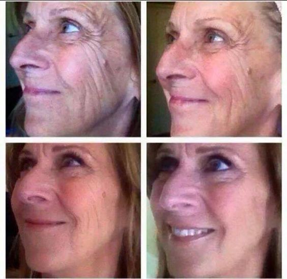 neriumjulie's tweet photo. Si estás pensando en hacerte una cirugía, antes prueba #Nerium y me cuentas que tal te fue? https://t.co/FrSUzZbe2V https://t.co/WZH6E2MfNS