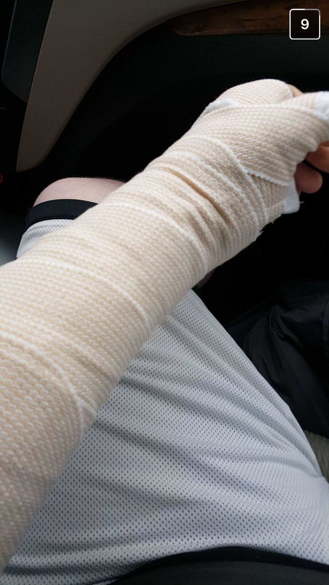 Lobkosh's tweet photo. Wishing a speedy recovery to @DefinitelyCamba who suffered a fracture to his left hand in yesterday's tournament❗️ https://t.co/I5LHX1YsTP