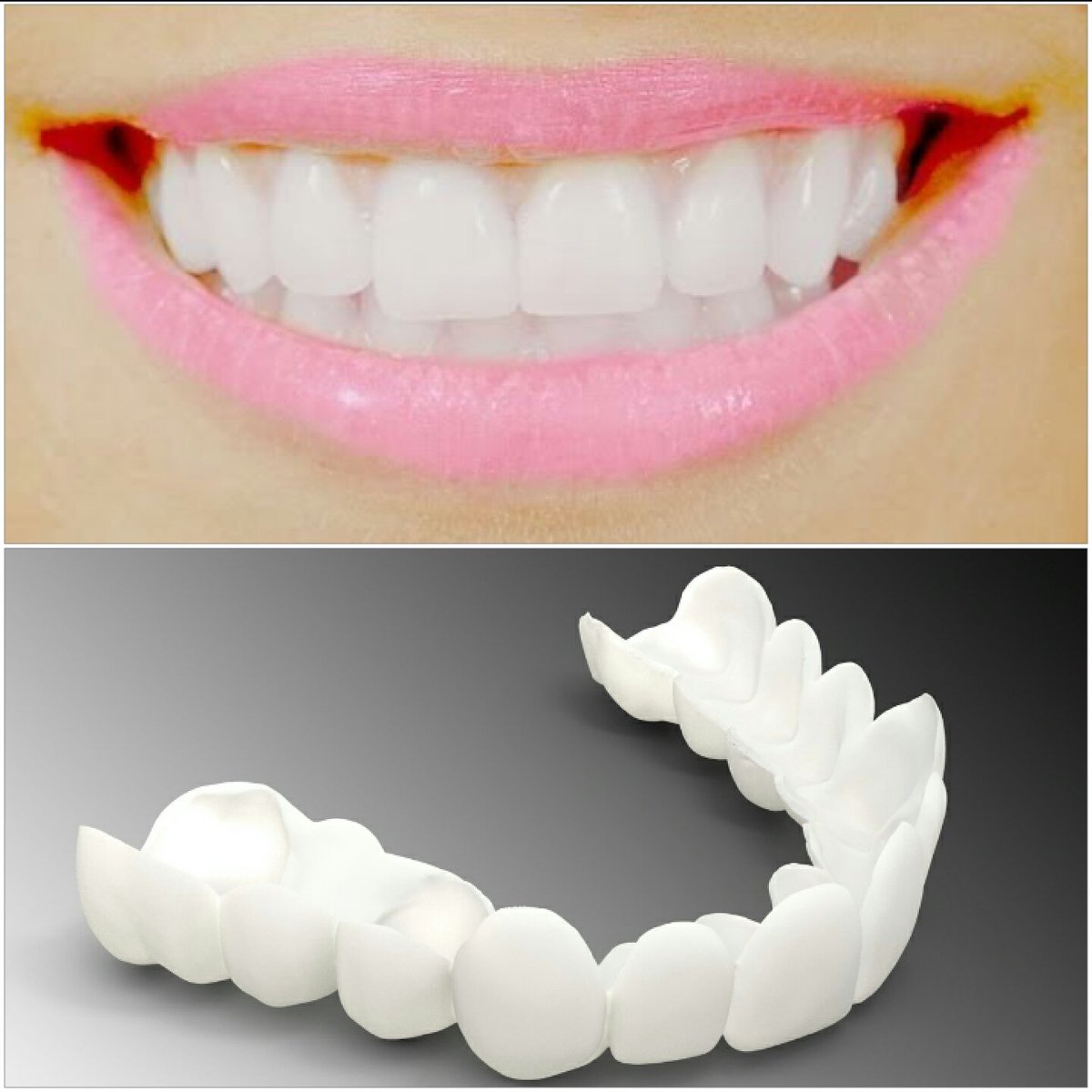 secretveneers's tweet photo. More happy clients in #dorset #smile #clipinveneers #snaponsmile #essex #teethontour #teethgoals #beauty https://t.co/beLHYbE3oD