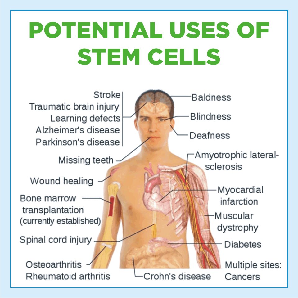 StemadeBiotech's tweet photo. SMS TEETH to 56767 to know more bout the health benefits of dental stem cell preservation. https://t.co/cp3hTQwnsx