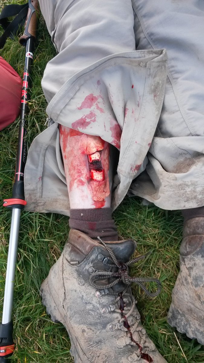 ActivemedTRG's tweet photo. Casualty simulation is an important part of our training.Receive training from emergency services personnel https://t.co/UCCi5nI319