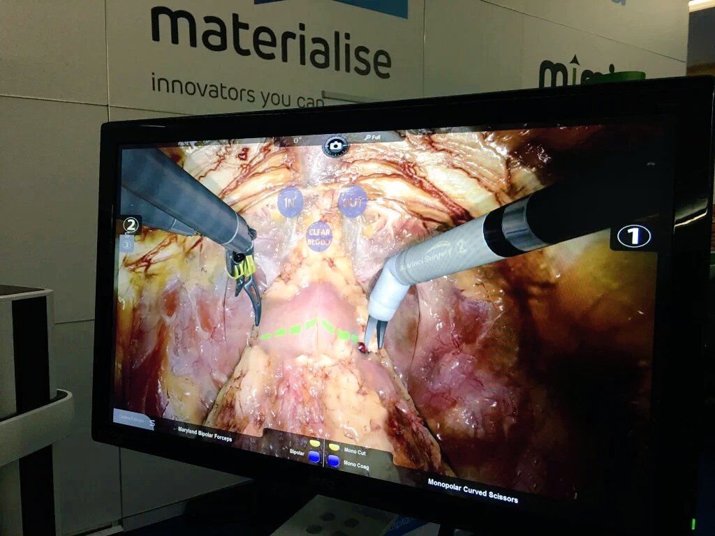 abdullatif_aydn's tweet image. New #RARP module on @SimbionixUSA #RobotiXMentor - Basic skills validated by our team on @JEndourology #EAU16