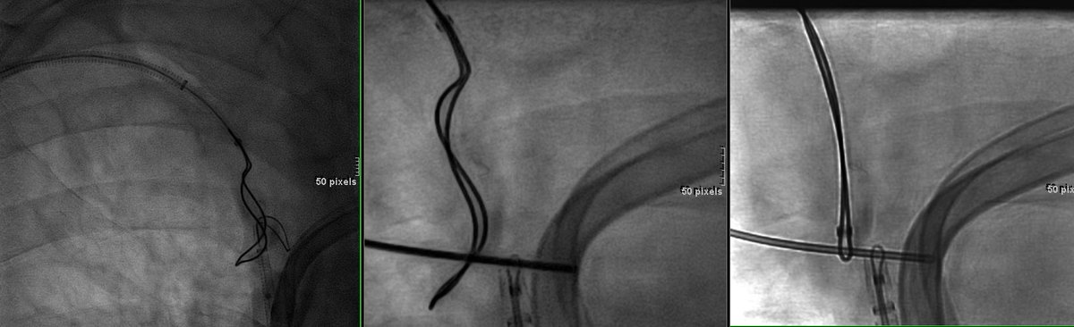 Mount Sinai IR tweet media