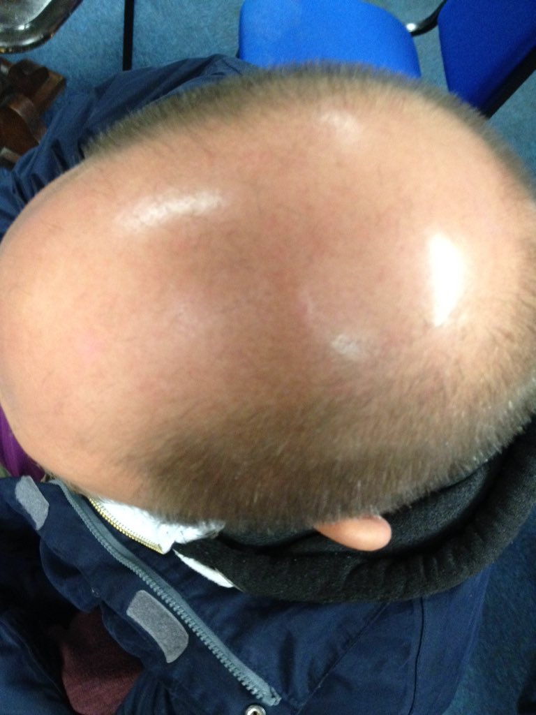 Skittles trivia - guess who? #idiot