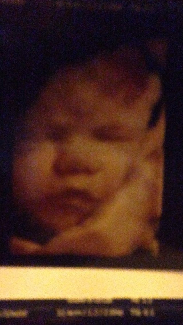lindseyexstatic's tweet photo. Our child is the cutest already @hill1981paul xxx https://t.co/BsRDoyTLBM