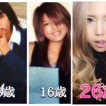 半魚人と呼ばれた少女が努力で美を追求した今の姿がコレ!
