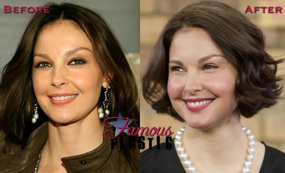 Madison Holiday on X: "Ashley Judd Plastic Surgery --> https://t.co/zLfDWpsq2x #AshleyJudd #ScienceFoods #BETHonors #AskOrion #HitTheFloor https://t.co/r7NwtTFG0q" / X