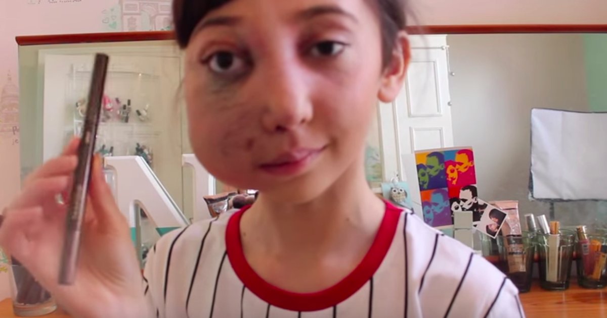 HuffPost's tweet image. Beauty vlogger with rare condition totally slays with a flawless attitude huff.to/1pCkIqU