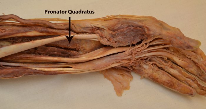 evbasedphysio's tweet photo. The pronator quadratus muscle in MSK ultrasound - J Ultrasound Med 2016: https://t.co/N3HMCsMoBO https://t.co/O8Ndvt3WNc
