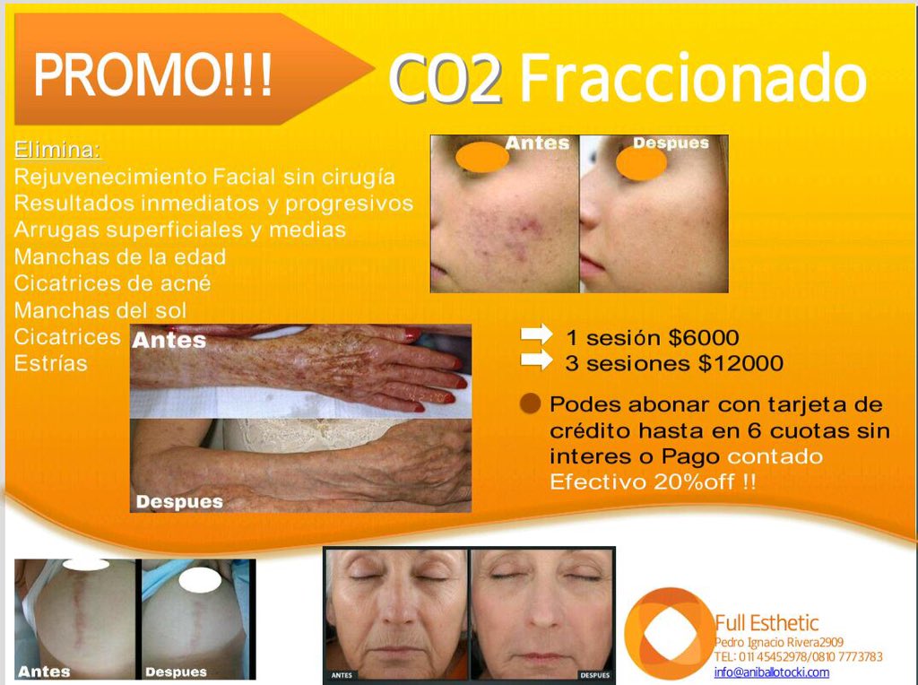 FullEsthetic's tweet photo. Elegí la mejor opción para el cuidado de tu piel! 45452978 consultas@aniballotocki.com https://t.co/Cja3Mk1dFy