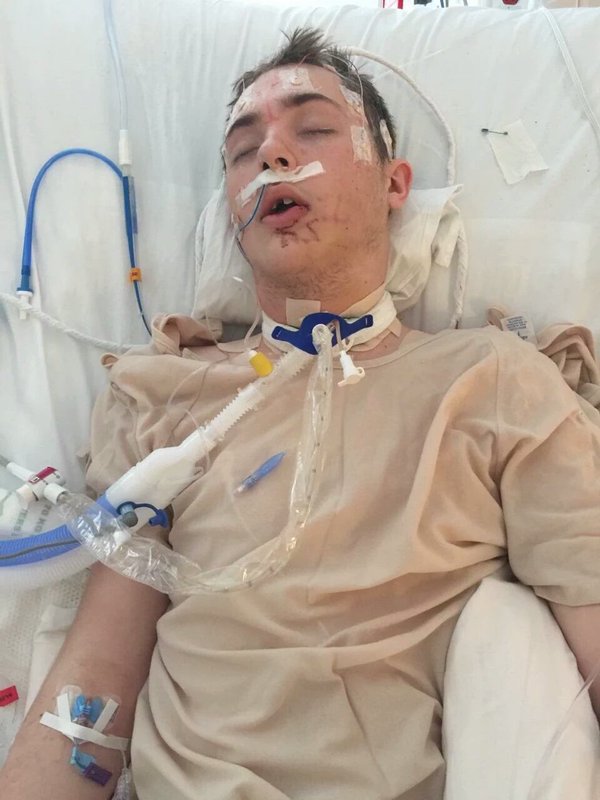 twins_n_wins's tweet photo. Please pray for Noah's family and friends, and share his story in honor of TBI awareness month! #BattleOfTheLear https://t.co/dpI4mv5E20