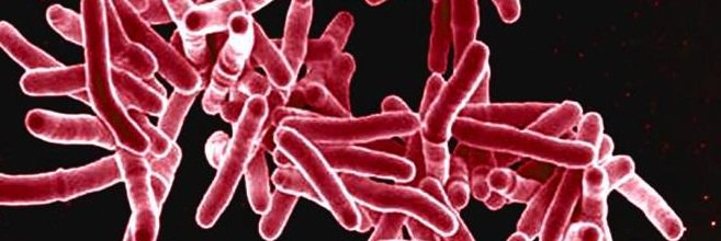 DrMerminCDC's tweet image. You need to know difference between latent #TB infection &amp;amp; TB disease. This is it: go.usa.gov/cGMG9