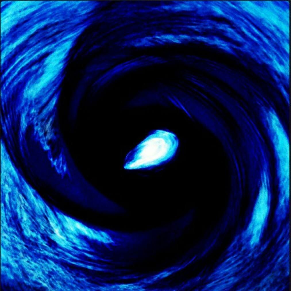 bio_vortex's tweet photo. I like to fall asleep with visions of vortices dancing in my head #biovortex https://t.co/vOFIlLGM0y https://t.co/cCDXzbwIxz