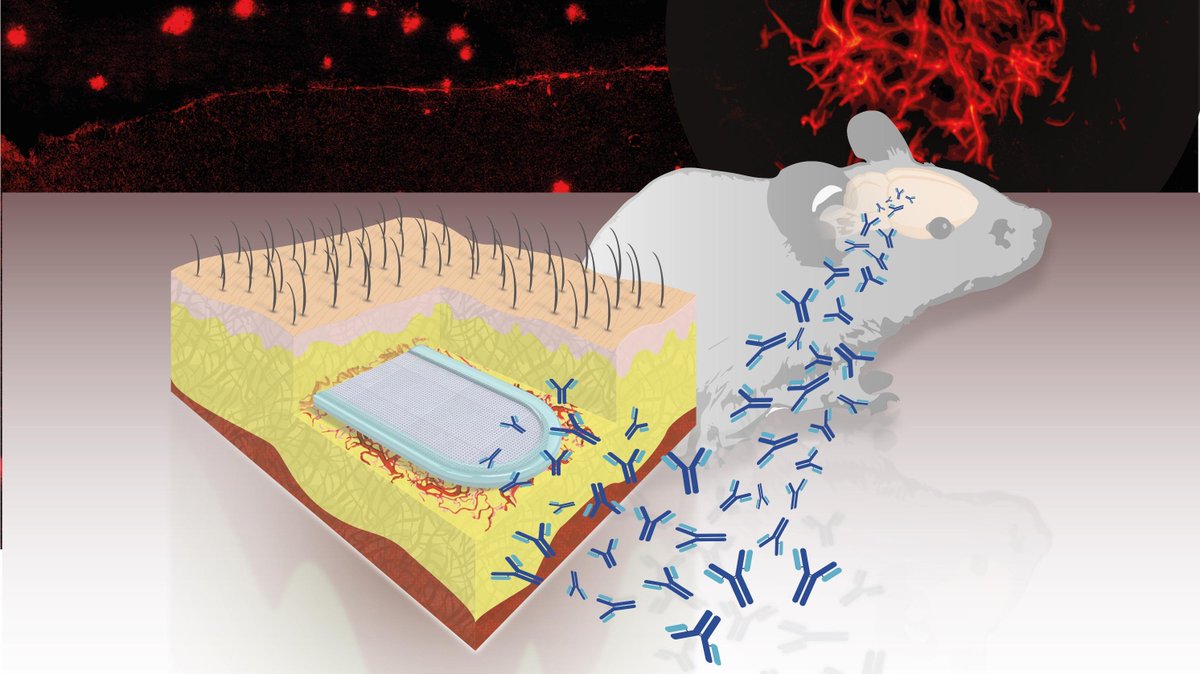 EPFL_en's tweet image. Researchers develop an implant to prevent #Alzheimer&apos;s actu.epfl.ch/news/an-implan… #epflSV