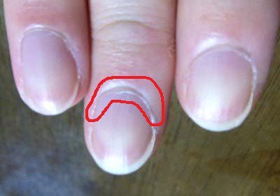 ネイルマニア على تويتر 甘皮 あまかわ 爪の生え際にある薄い皮膚のことで 新しい爪を作る爪母基 そうぼき を守る役目を持っています T Co Rgby8xmhlv