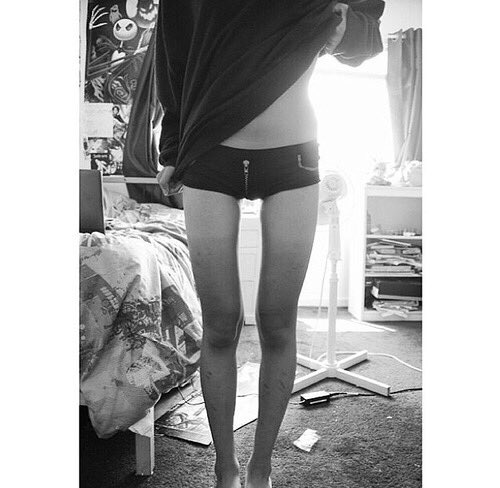 anamia_5's tweet photo. #thinspo https://t.co/yRi8SIXfqP
