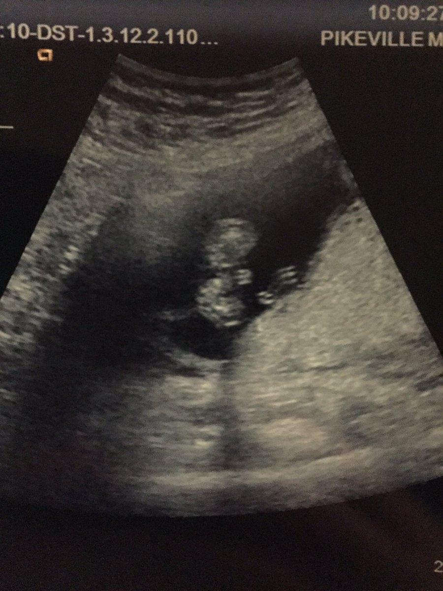7etrain's tweet photo. Happy to say I will have another nephew in August!!! https://t.co/ZHv6PBsiaO