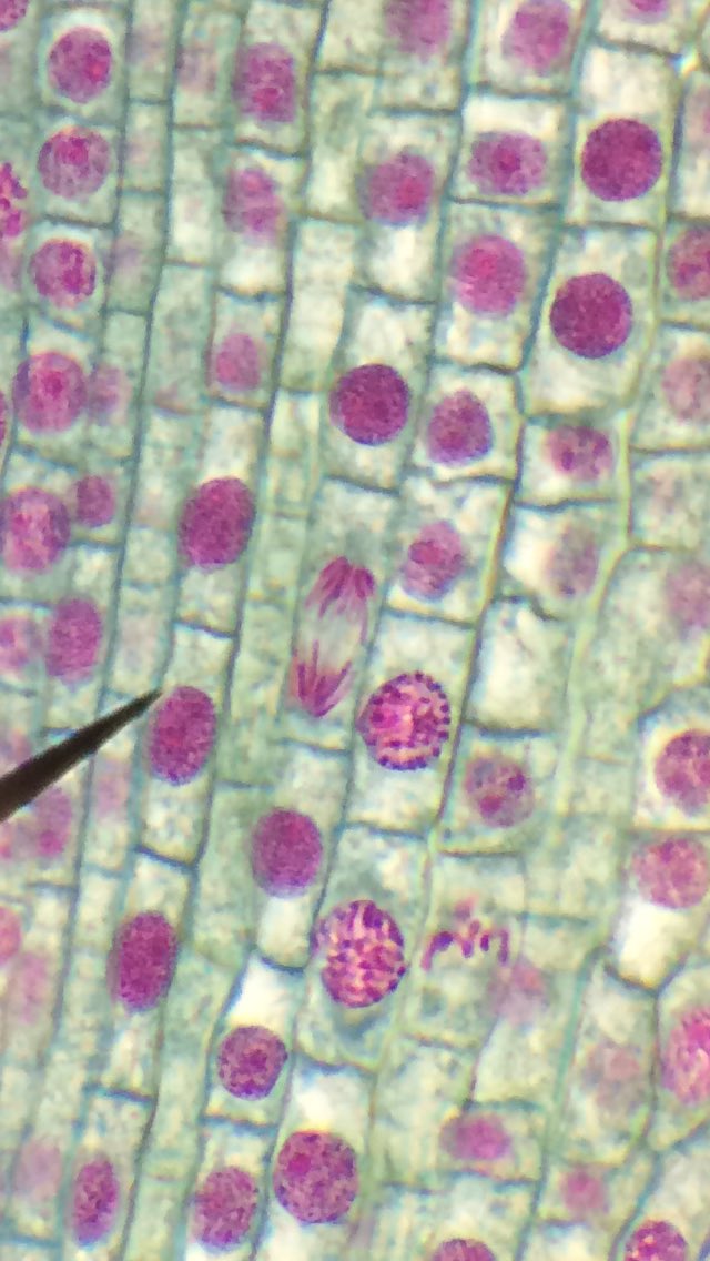 AlexisGandora's tweet photo. I found anaphase in an onion root tip👍🏼 @UNKBiol106AC #CummingsWeek10 https://t.co/tb0y8oSKiY