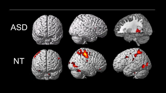 Study finds lags in unconscious learning among adults with #autism. goo.gl/486y3E