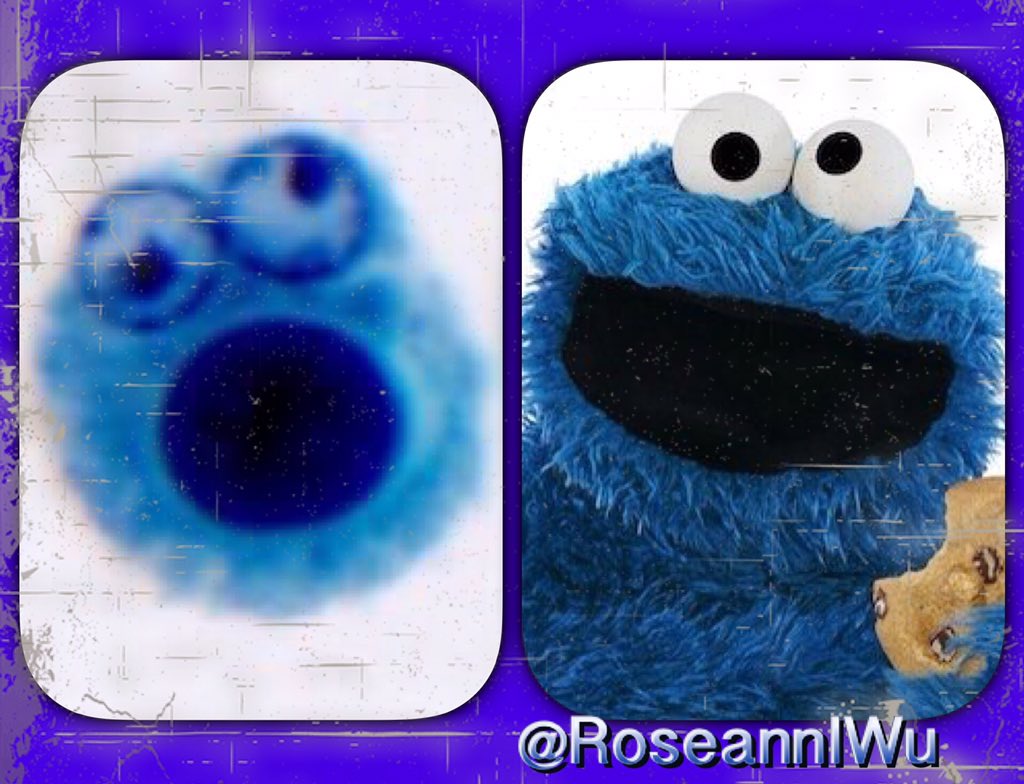 pembeoltulu's tweet photo. πππ»ππ» #pathart #POpath @RoseannIWu @cytopathology https://t.co/OAe48wXblT