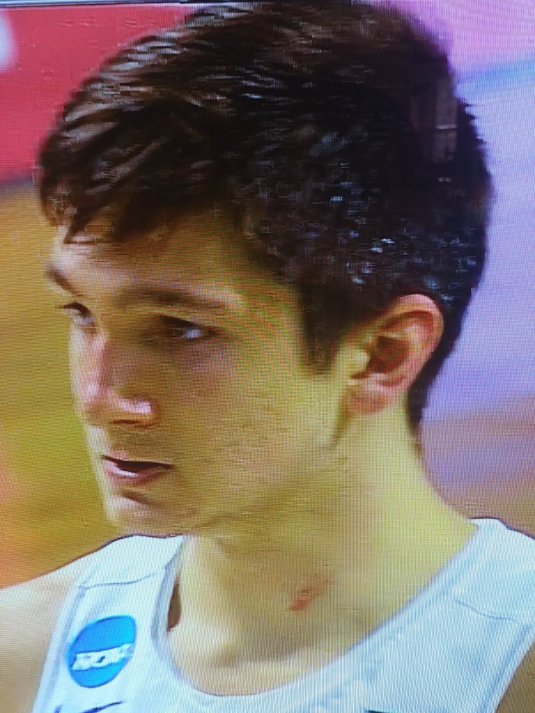 MaybeSethDavis's tweet photo. @SethDavisHoops gave Grayson a hickey https://t.co/LL76sKf2Qw