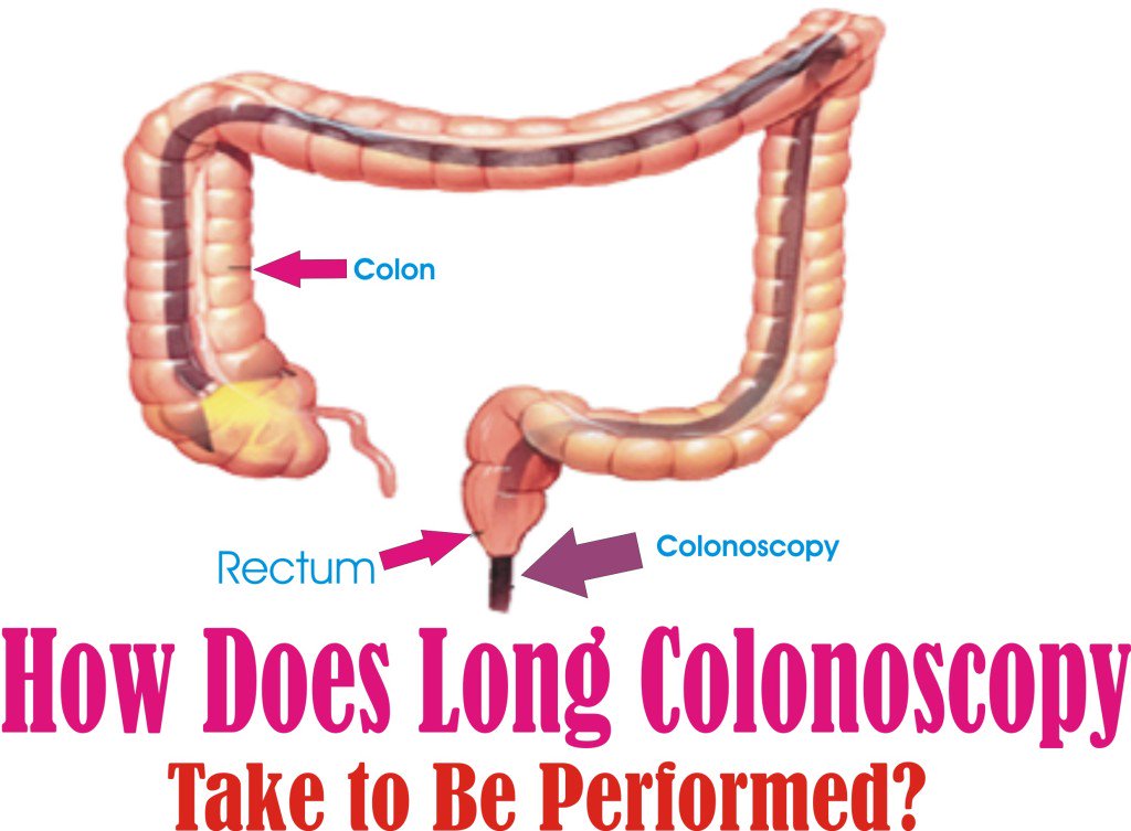 HdKnowledge's tweet image. How does long colonoscopy take to be performed? - lifegot.com/how-long-colon…