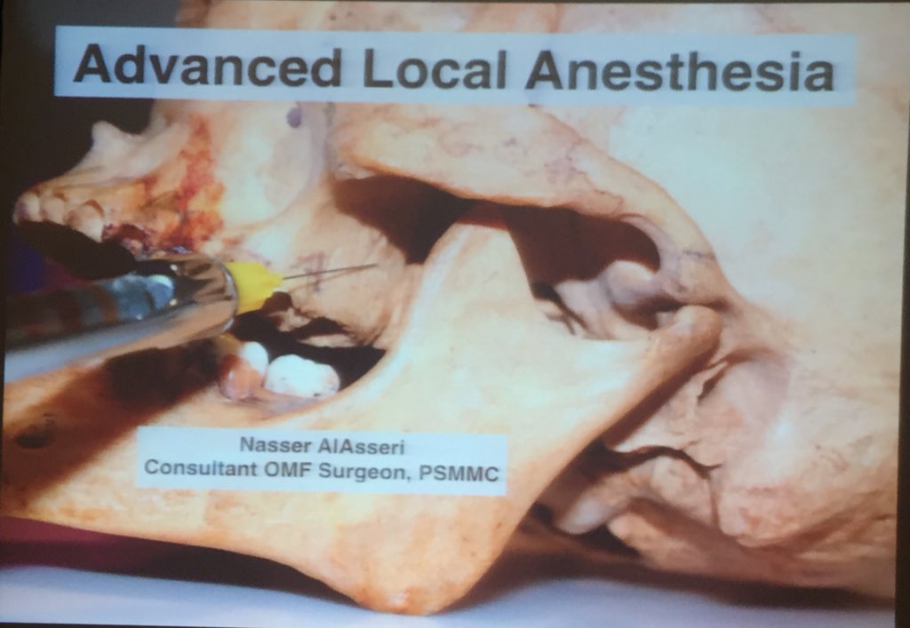endo_edu's tweet photo. A workshop of "Advanced Local Anesthesia" by @NASSERALASSERI at @5thEndo https://t.co/JzifBoRLfO