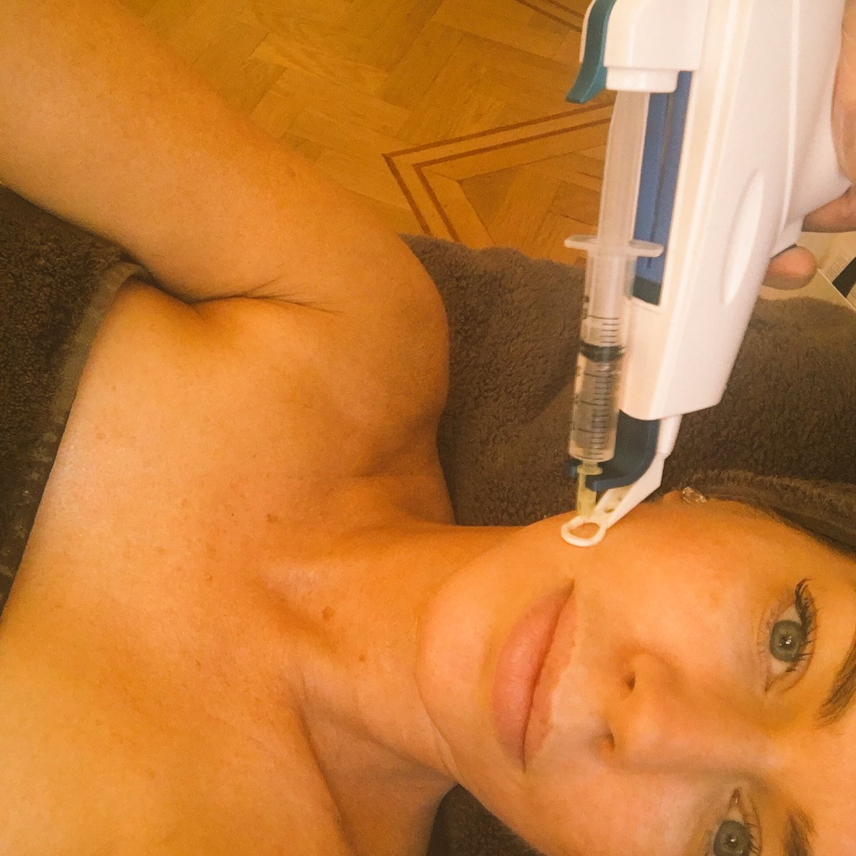 C_Stanbury's tweet photo. @clare_marie75 first time #misotherapy and #venusfacial together 😍 https://t.co/uRqiCkRe3g