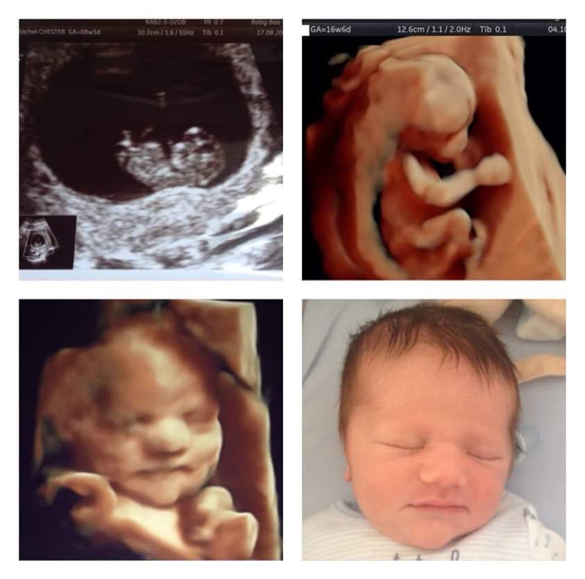 BabyBooScan's tweet image. Bobby Luke who we scanned from 8weeks #4dscan #genderscan #newborn #baby #boy #lancashire #cumbria