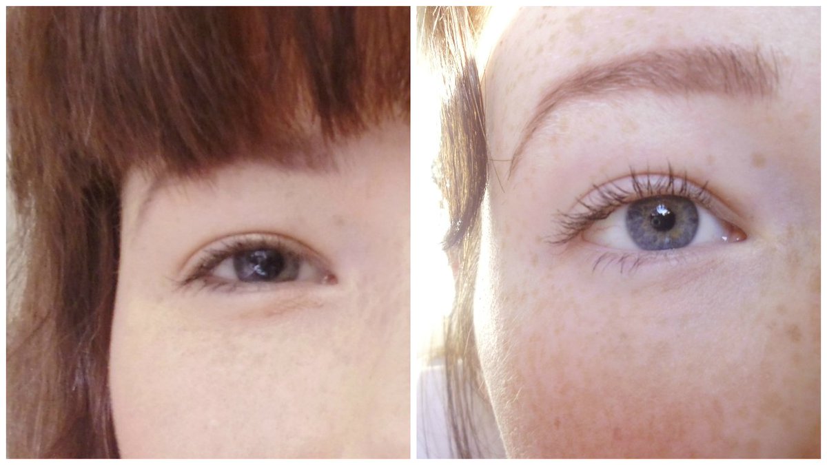 fLashEyelash's tweet photo. Why, hello there #lash transformation! Check out @nothingIikethis blog post on #fLashSerum: https://t.co/IG70aXeuQ3 https://t.co/PeXhMRikVQ