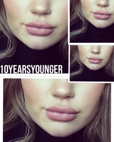 All pictures done by our specialist nurse. Follow our instagram to check out all our work 💋💄<a href="/10yearsyounger_/">Me</a>