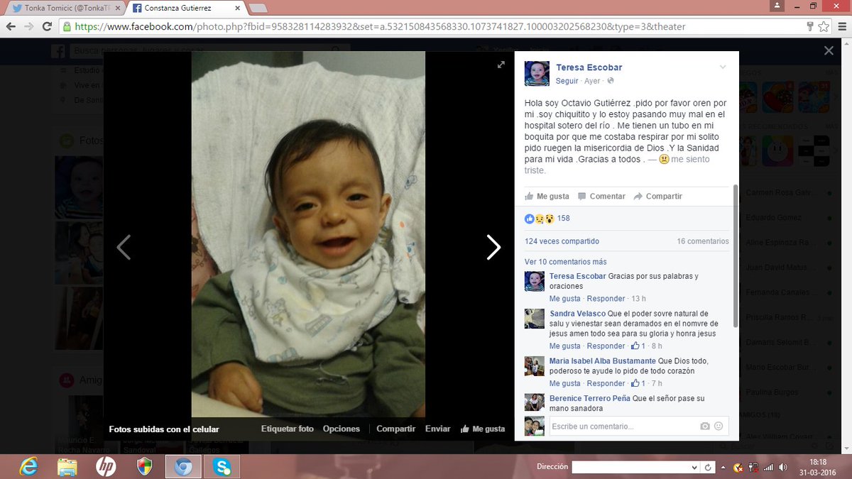 yeni_l's tweet photo. @TonkaTP angelito necesita transplante de medula, esta grave en hospital sotero, cualquier ayuda porfavor https://t.co/0I3ARzbqUH
