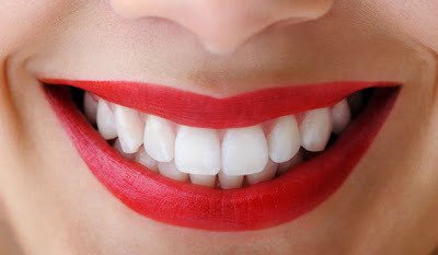 Lbedokis's tweet photo. #Tip: If you want to brighten your #smile, start treatments about two weeks before your shoot. #photography #whiten https://t.co/SrLBqnqWBd