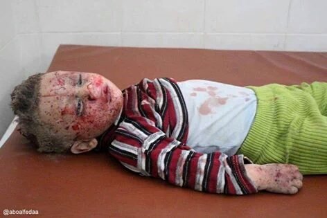 Free_Media_Hub's tweet photo. Assad still massacring the Syrian population it's just off the world's radar now #syria what #Ceasefire? #Geneva #UN https://t.co/BY2RPi3o82