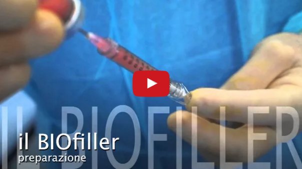 gennaichirurgia's tweet photo. #biofiller come si evolvono i filler del 3° millennio https://t.co/0nivPPUcXH https://t.co/uTQr1PM6Ty