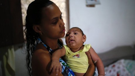 CBCNews's tweet photo. Zika virus's causal link to microcephaly, neurological disorders grows:  WHO https://t.co/OkwTdP3yOD https://t.co/wvhHnr1Mxd