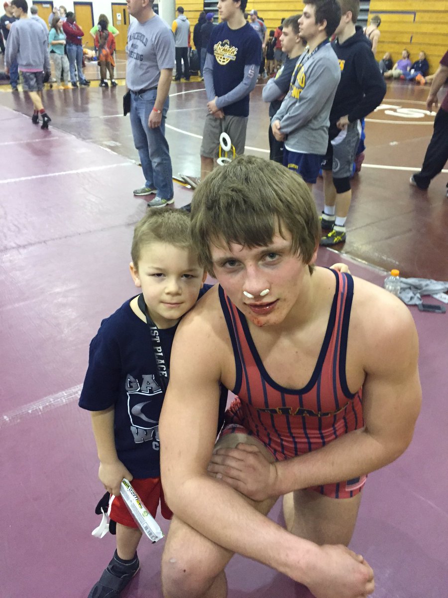 Team_Poppe's tweet photo. Battle scars from the Iron Eagle! #heavyhandz #bulldogs https://t.co/8sEKlhlroD
