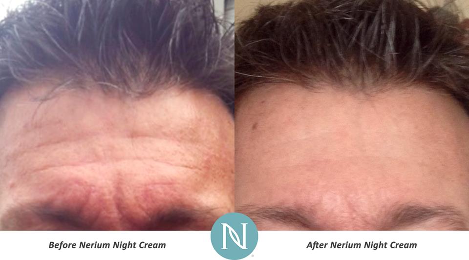 julyprie's tweet photo. !Wow! rejuvenecer en forma natural no tiene precio. Prueba #Nerium y compruébalo. https://t.co/rwNvQ33z7s https://t.co/UwRfzuV69x