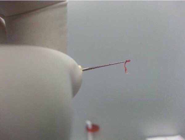 iMoqtarib's tweet image. صورة لعصب السن الذي لو (اِلتَهبَ) عليك لضاقت بك الأرض بما رحُبت ؛ ﴿ وخُلق الإنسان ضعيفًا ﴾.