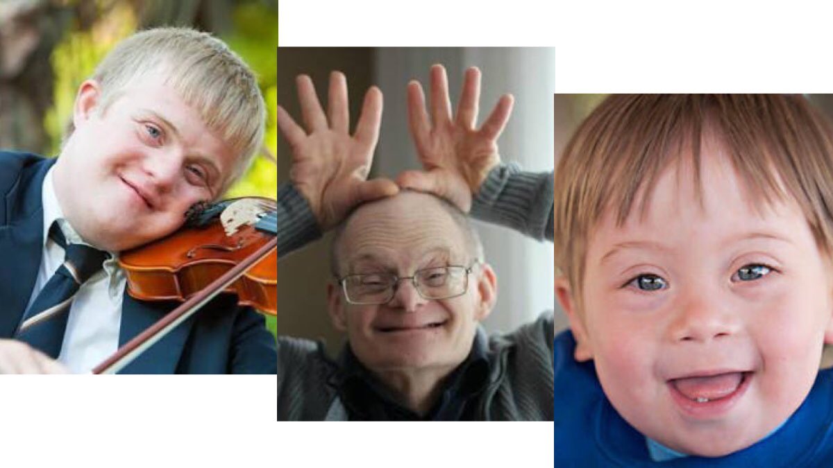 Bugün 21 Mart; Dünya Down Sendromlular Farkındalık Günü 👼🏼 Gerçek dostlar kromozom saymazlar..