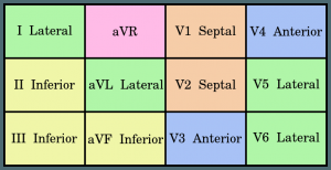 RewAU's tweet image. Do you pay attention to aVR if your patient looks sick ? foamlinks.com/2016/03/nobody…