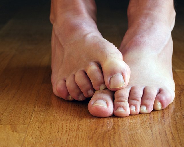 OzoneDeodorant's tweet photo. The Best Trick For Combatting Smelly Feet Is ... #Deodorant

https://t.co/dxvgnl1z27
#OzoneLayerDeodorant https://t.co/x5YaxW0Ak1