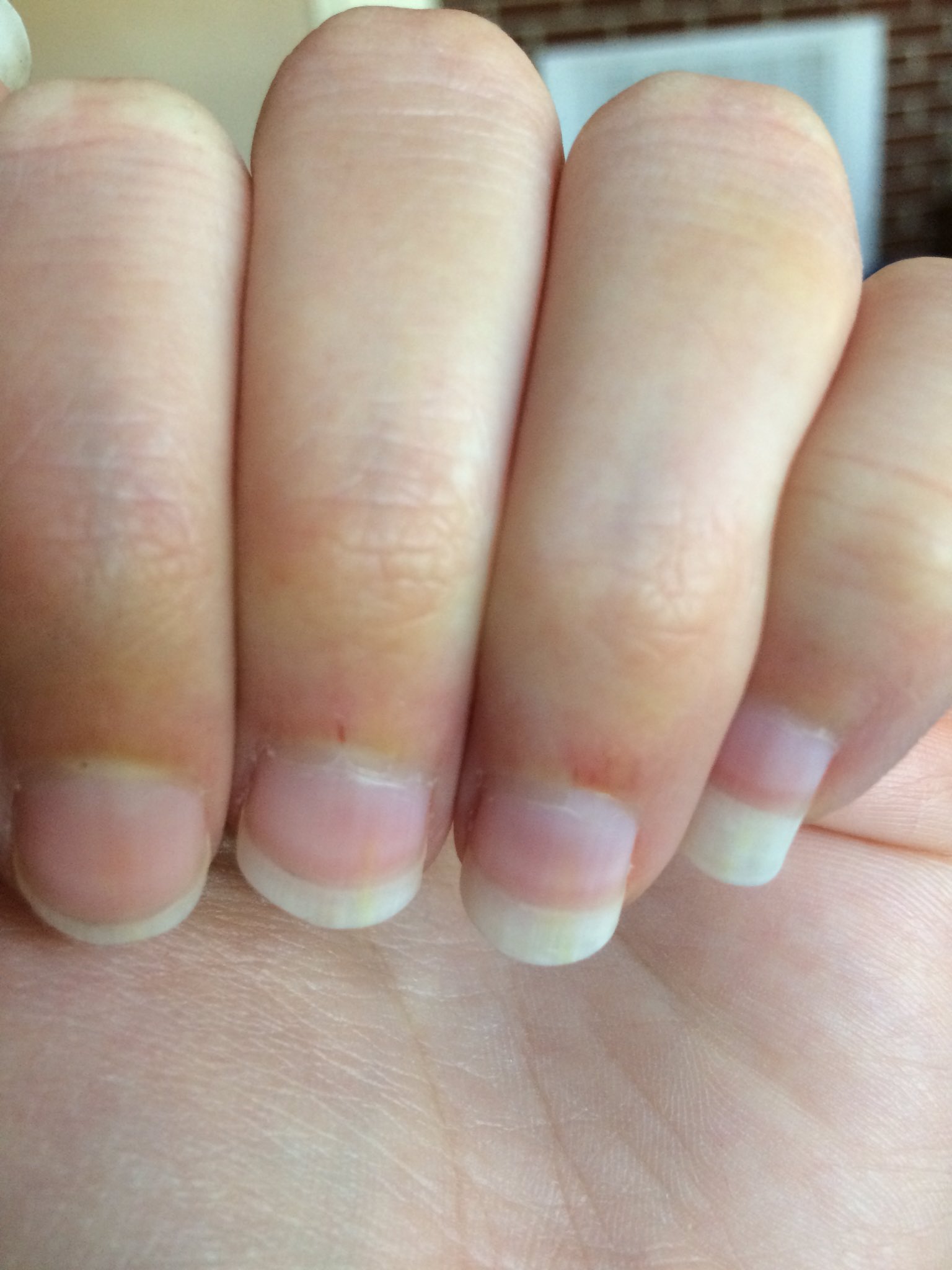 Why are my nails constantly dirty? : r/TheGirlSurvivalGuide