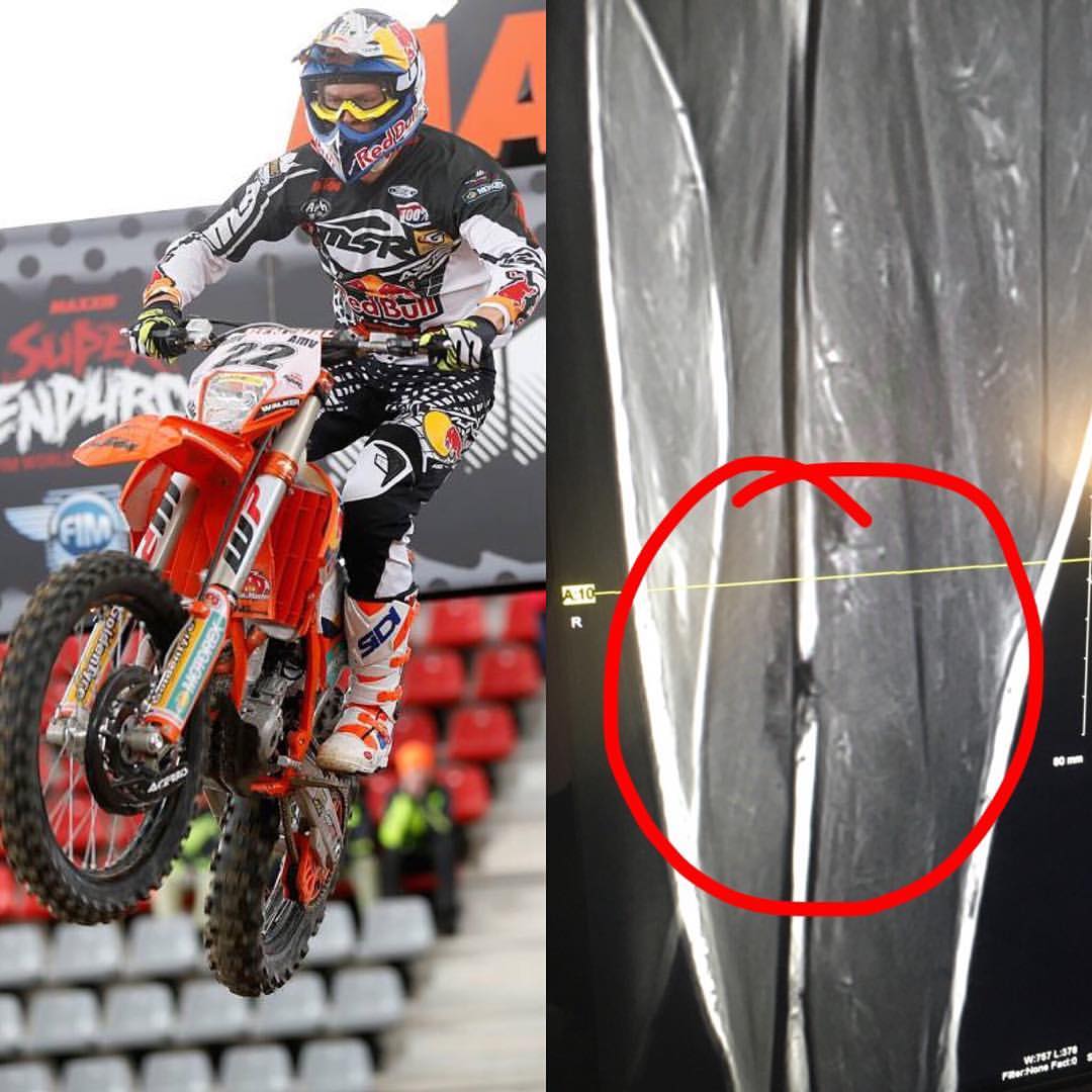 Jonny Walker termina el campeonato de #SuperEnduro fracturado el peroné
Se lesionó en el #GPCzech la anterior semana