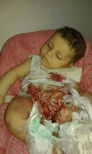 ebrahiim16's tweet photo. #USAKillsYemen
#امريكا تقتل الشعب اليمني https://t.co/YrDKFH3aeb