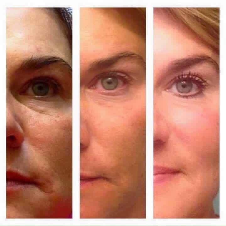 neriumjulie's tweet photo. Rejuvenecer 10 años, te gustaría? Prueba #Nerium y empieza a ver desvanecer tus arrugas https://t.co/I5ahArdjSd https://t.co/Sp6CPcEOA5