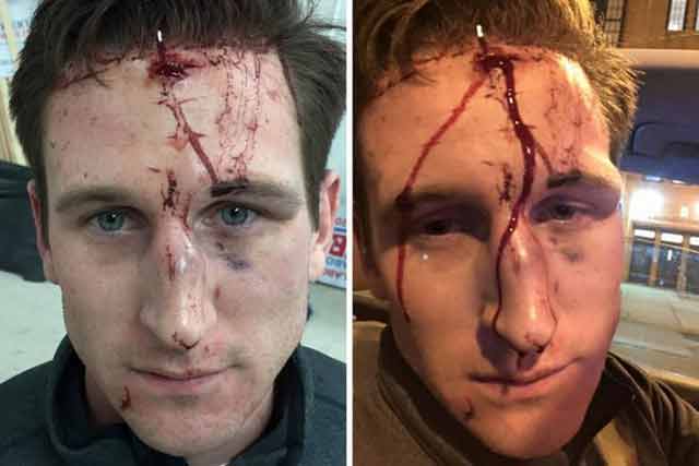 RedGunTactical's tweet photo. Politician’s daughter charged for staple gun attack against mom’s rival https://t.co/Z689NgumiS https://t.co/7GdrtYyC6E