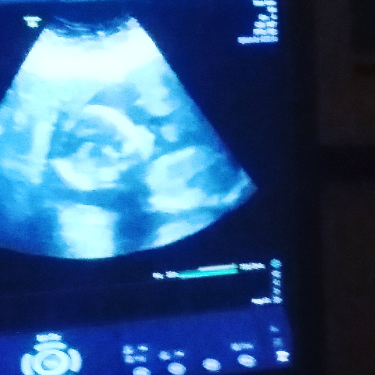 Babymodelmalak1's tweet photo. This is me baby model Malakai Daniel Boyd I will be here in 4 more months https://t.co/K10BldbBGE
